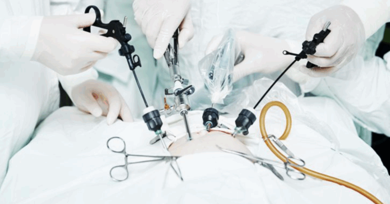 Laparoscopic Surgeries at Novocare Hospital: Minimally Invasive, Maximum Benefits